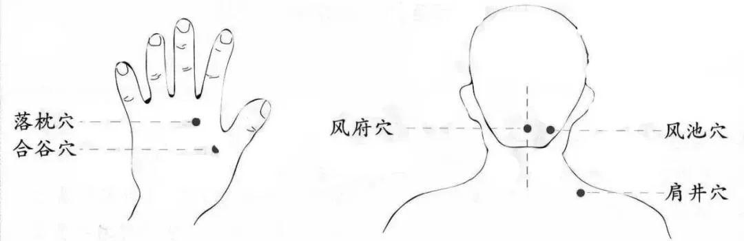 一觉醒来脖子疼痛、僵硬,“落枕”了怎么办?