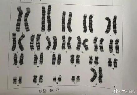 养了五年的儿子竟是女孩 父母最终决定按男孩抚养