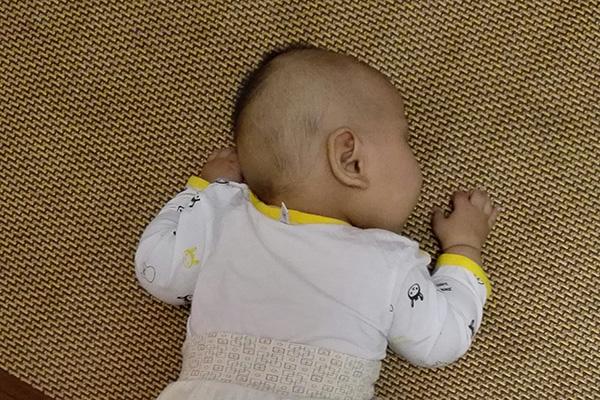 是血管瘤还是鲜红斑痣？如何鉴别婴儿时期的血管瘤？