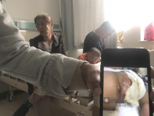 天气太热？小宝宝刚坐上滑梯就大哭，外婆发现娃已被烫掉一块皮