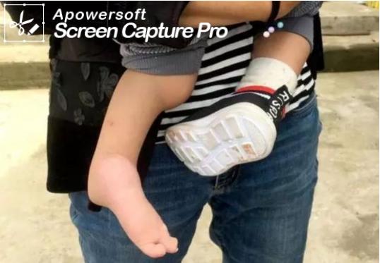 【惊呆】两次产检没问题，孩子出生后吓到了！现在只能爬行...