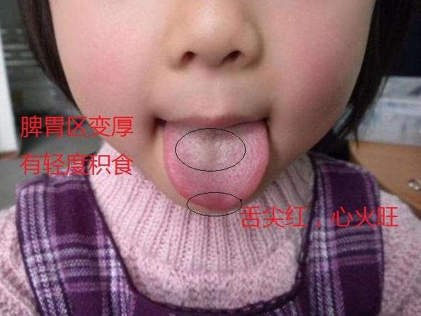 宝宝有没有积食？留意这4个“信号”，新手宝妈尤其要注意