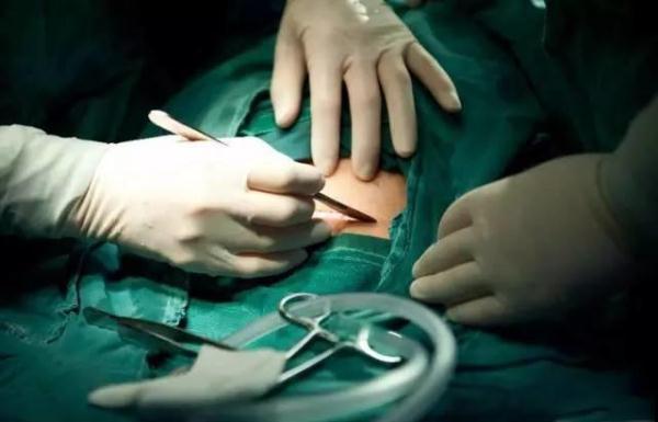 剖腹产会划伤孩子吗？避免划伤宝宝，孕期和生产时要注意5点