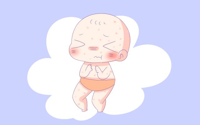 宝宝湿疹治不好？可能入了这些误区，选对方法是关键，宝妈别大意