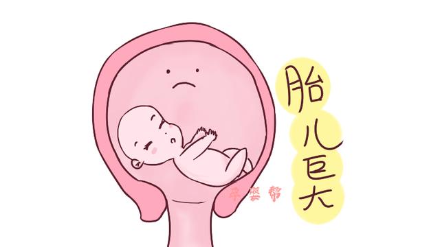 当出现以下情况时，即使生二胎也难逃侧切，但愿其中没有你