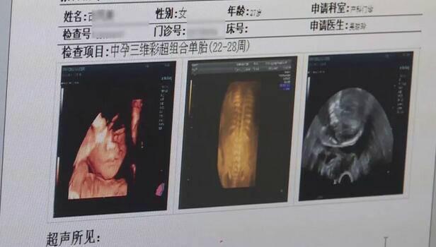孩子即将出生，却被医生硬塞回娘胎！这是什么操作