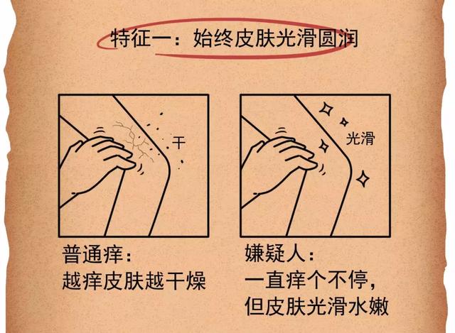 孕期皮肤这样痒，小心胎儿有危险！
