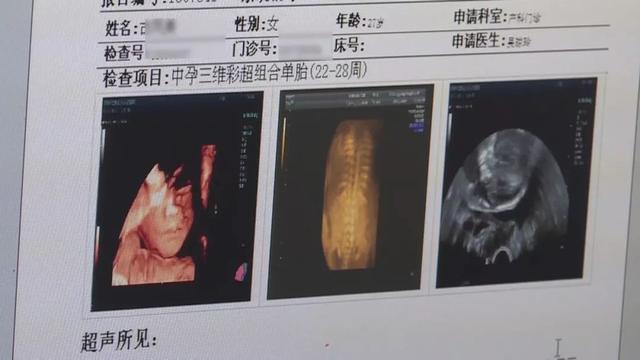 孩子即将出生，被医生硬塞回娘胎……