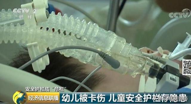 儿童安全护栏又出事故，河南宝宝大脑受损，家长们还不重视？