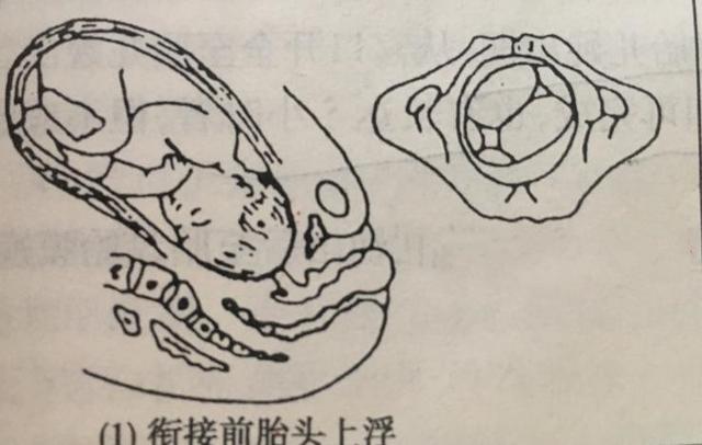 孕妈分娩时，胎宝有8个规定动作要完成，不然可能无缘顺产