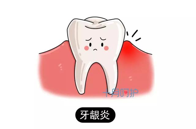 孕期口腔问题会影响胎儿健康！做好这几点很重要