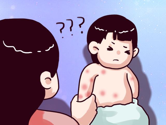 世界上还有人对水过敏？1岁女孩患水敏症，流泪都会伤害自己！