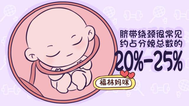 宝宝有多活泼，脐带就有多喜欢绕他脖子，脐带绕颈你知多少？