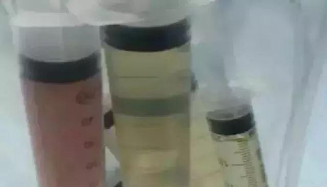 4岁男孩肚子大如怀孕，医生抽出2斤寄生虫液！身边的虫源要重视