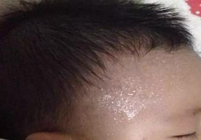 天热对付痱子，知道这4点，孩子少受很多罪