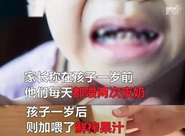 可怕！2岁半宝宝牙齿“全烂光”，别让这些坏习惯害了孩子