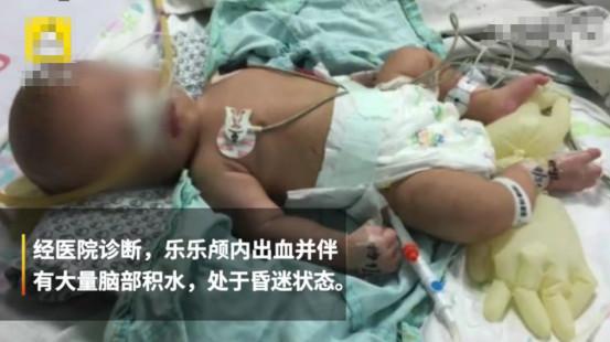 丈夫和妻子吵架后殴打2个月大儿子，4年过后，孩子仍不会说话