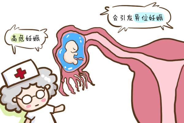 孕妈若是有这四个特征，说明可能是“高危”孕妇，可别不当回事儿