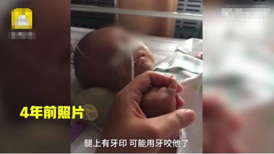 丈夫和妻子吵架后殴打2个月大儿子，4年过后，孩子仍不会说话