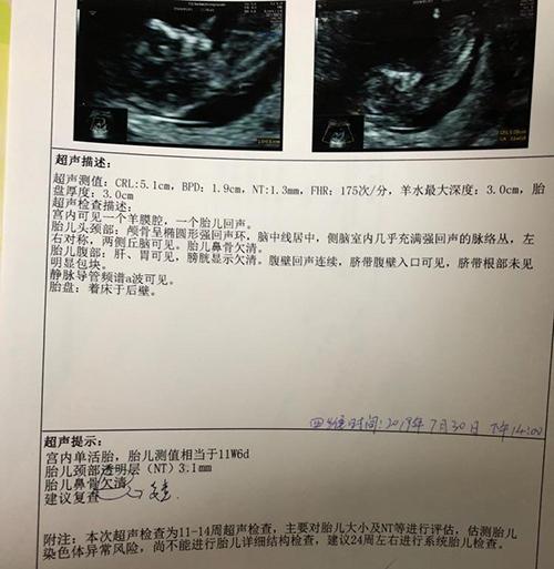 38岁女人2次流产后怀孕，医生却让打掉，宝宝出生吓得医生往后退