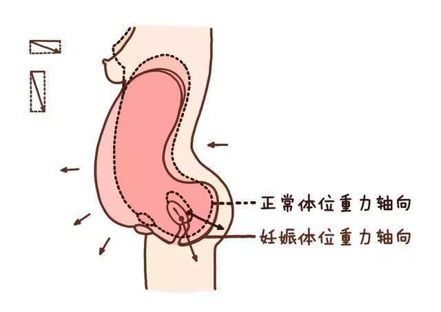 产后漏尿、松弛怎么回事？医生找到了原因，一个简单运动帮你搞定