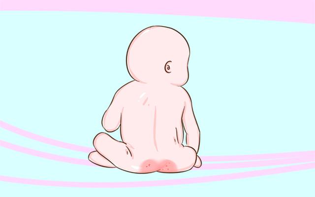 宝宝出现“红屁股”？尿不湿：我不背锅，其实是宝妈的这些行为