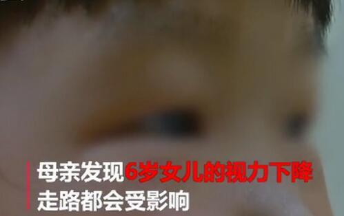妈妈生二胎大女儿癔症性眼盲怎么回事？癔症性眼盲是什么如何引发的