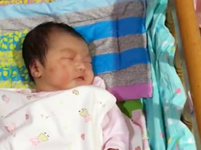 宝宝脸上产钳印几个月还没下去，婆婆埋怨指责，妈妈反而笑了