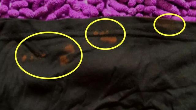 孩子说幼儿园洗手的水很臭，居然用消毒水“消毒”孩子？