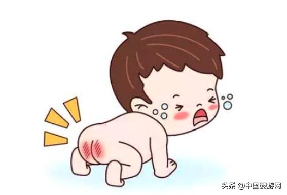 崔玉涛：夏季如何预防宝宝红屁屁？赶紧收藏吧