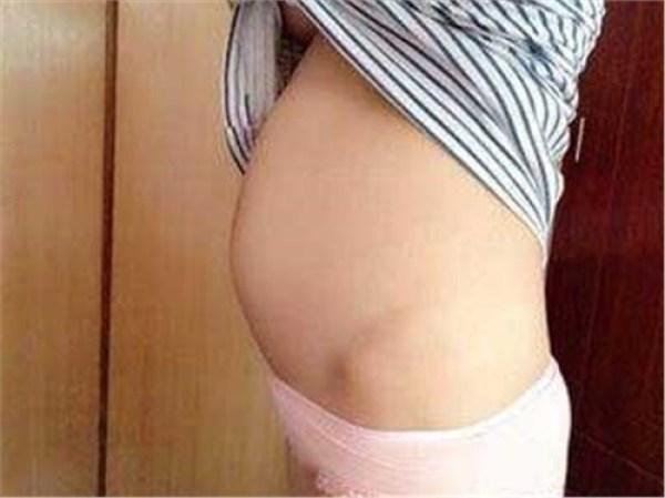 痛苦！！因怀上“葡萄胎”，婆婆对我特别嫌弃！居然还把我赶出去！！气愤