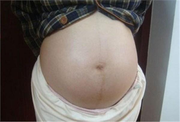 婴儿出生30分钟遭全身换血抢救，竟是因为妈妈“血型”惹的祸