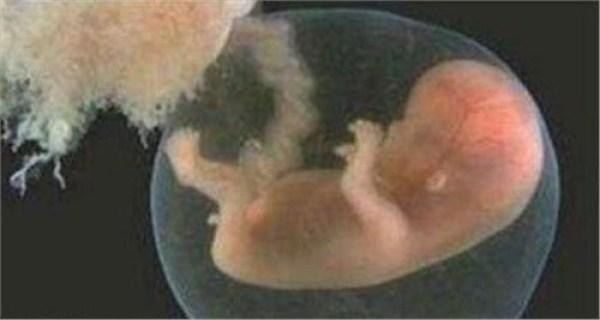 女子与三人发生关系并怀孕，孩子出生后，惊呆医生和护士
