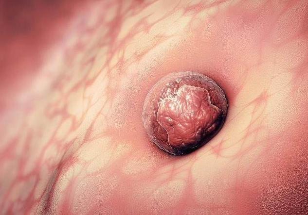 备孕很久没怀上，被告知“子宫内膜薄”，3个原因要清楚