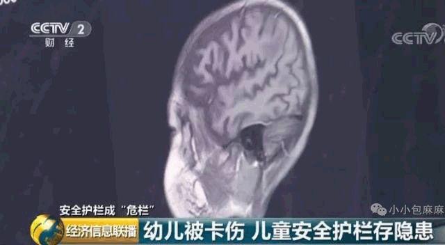 速查！80万件儿童床护栏被召回，快看这个“宝宝杀手...
