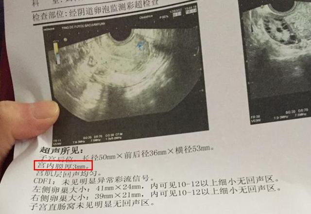 备孕很久没怀上，被告知“子宫内膜薄”，3个原因要清楚