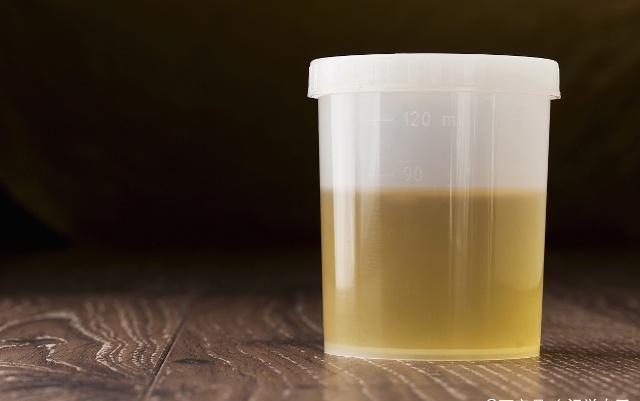 验孕棒一深一浅，是怀孕了吗？其实也可能是这4个情况