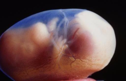 怀孕50天的孕囊大小是怎样的呢？若没出现胎心怎么办呢？