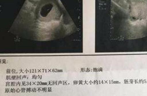 卵黄囊到胚芽需要多长时间呢？两者之间的关系，希望你不要错过