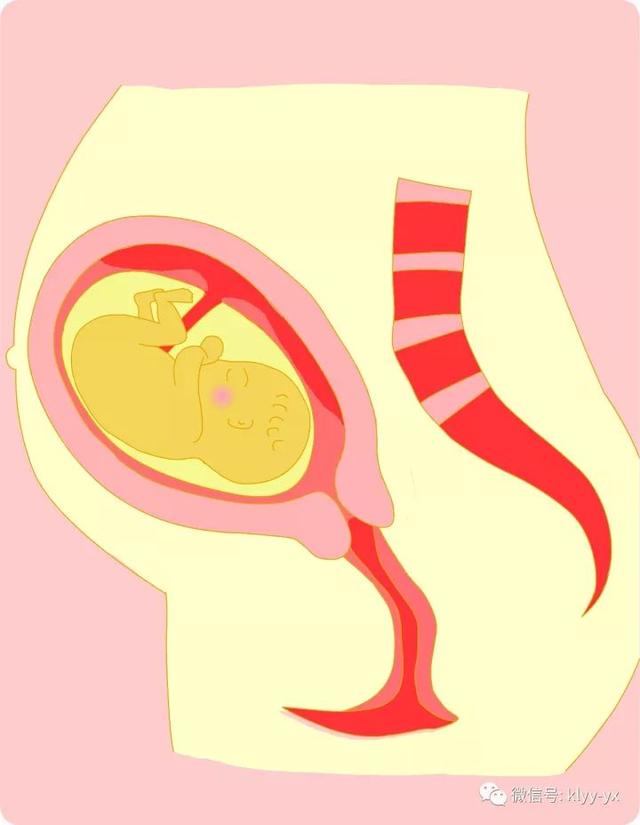 二胎后肚子更大了？告诉你“束腹带”背后的真相