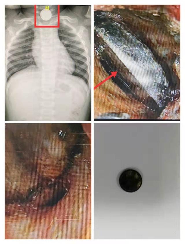 震惊！家里有娃的这篇文章一定要看，再忙也要阅读与转发
