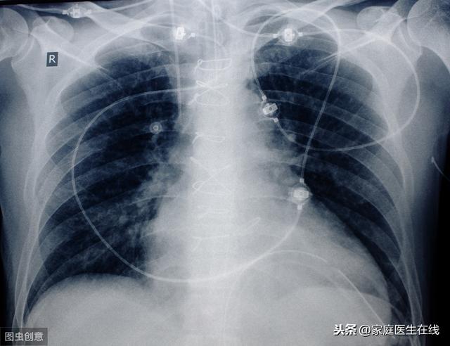 害怕X线检查？孩子有这几种病，该做检查还是要做