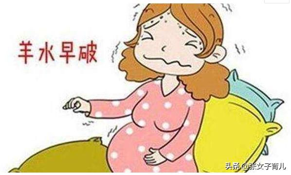 羊水破了怎么办？新手孕妈不要慌，做好这些事才保险