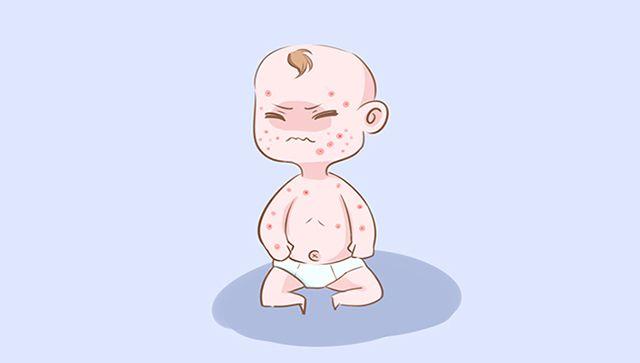 这几类宝宝容易招蚊子，妈妈提前做好预防，宝宝少受罪