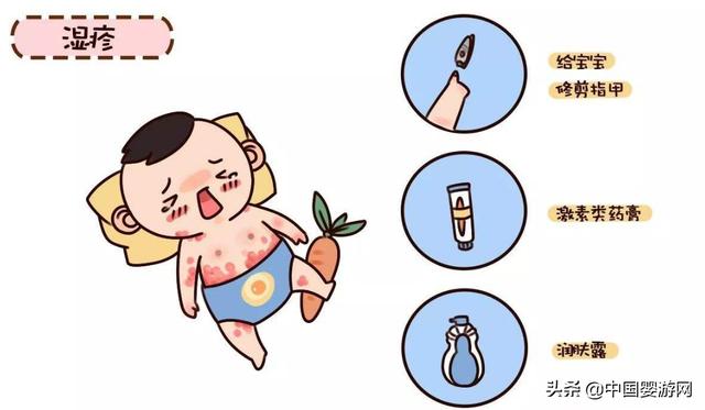 「别错过」五种常见的新生儿疾病及预防方法，很实用