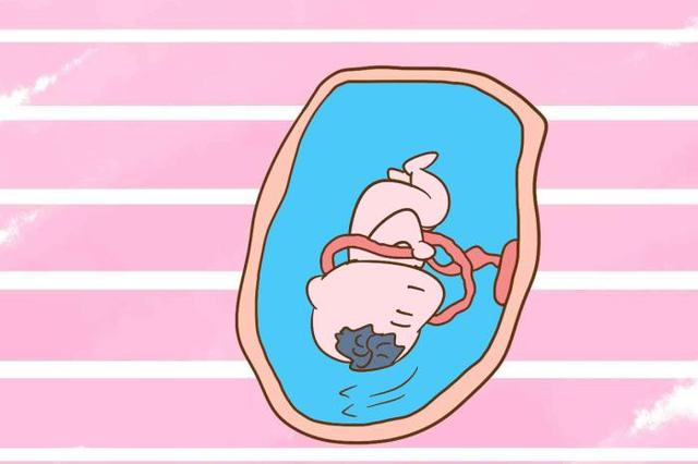 孕期胎动频繁，容易发生脐带绕颈吗？孕妇要心里有底
