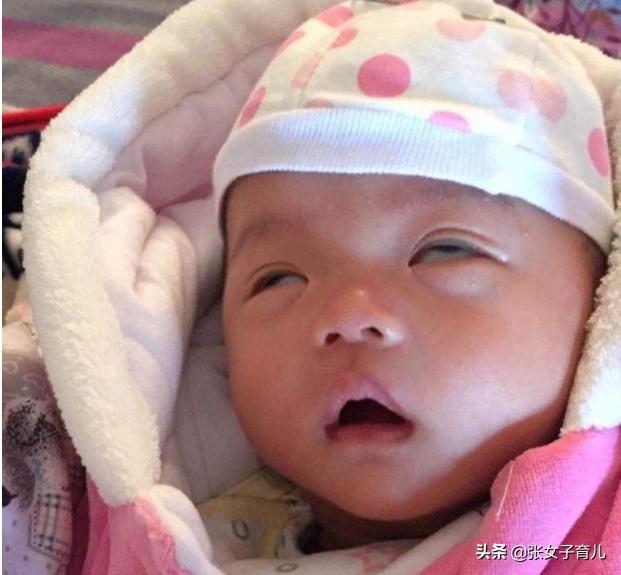 新生儿睡着后翻白眼，宝妈着急上火，医生却非常淡定