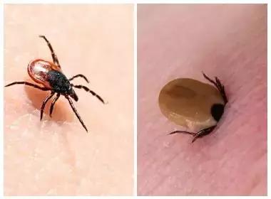 可怕！蜱虫钻入宝宝体内半截！医生：严重时可致死，勿大意