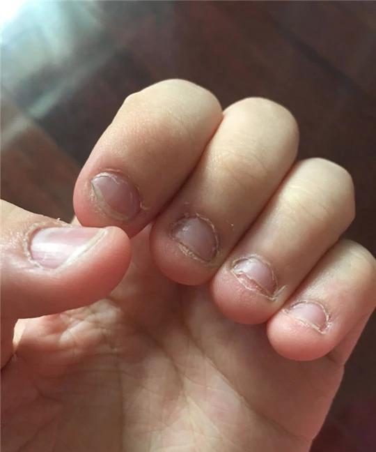 孩子总爱“啃指甲”，无非2大原因，家长要正确处理