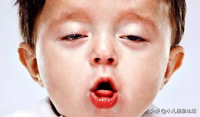 孩子咳嗽推拿不好？也许是寒热区分有问题，几招教你辨寒热